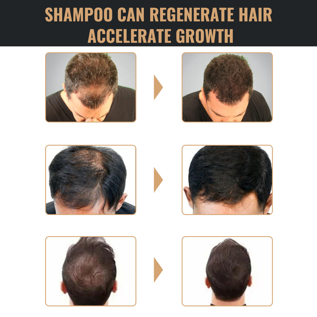 Shampoing Activateur de Racines – Noirceur & Cheveux Plus Épais