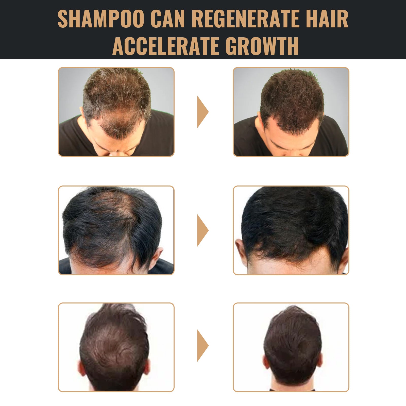 Shampoing Activateur de Racines – Noirceur & Cheveux Plus Épais
