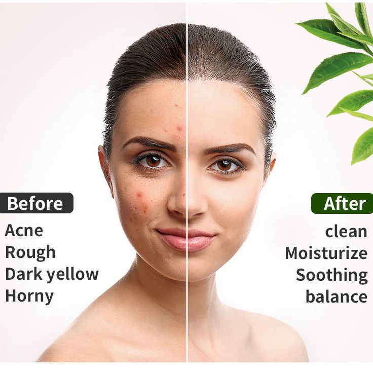 Matcha Purify - Masque Purifiant Anti-Imperfections