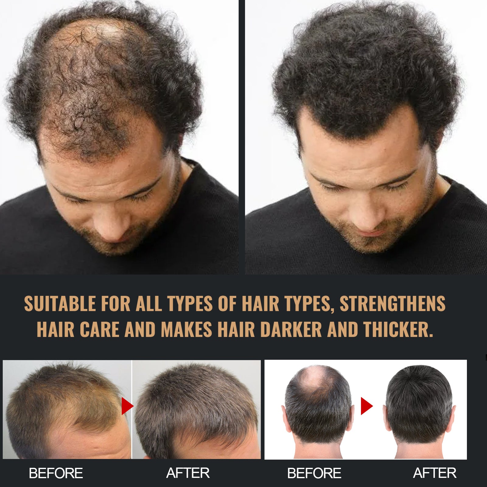 Shampoing Activateur de Racines – Noirceur & Cheveux Plus Épais