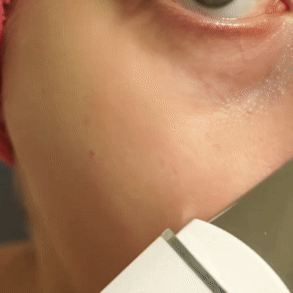DermaGlow™ Ultrasonic Pro – Appareil Nettoyant Visage Haute Précision