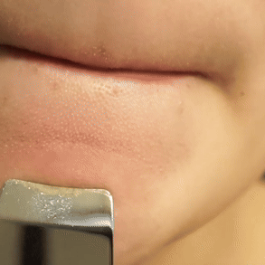 DermaGlow™ Ultrasonic Pro – Appareil Nettoyant Visage Haute Précision