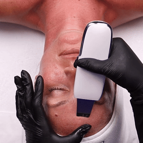 DermaGlow™ Ultrasonic Pro – Appareil Nettoyant Visage Haute Précision