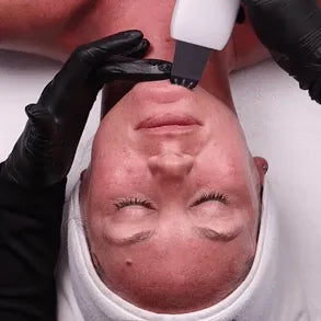 DermaGlow™ Ultrasonic Pro – Appareil Nettoyant Visage Haute Précision