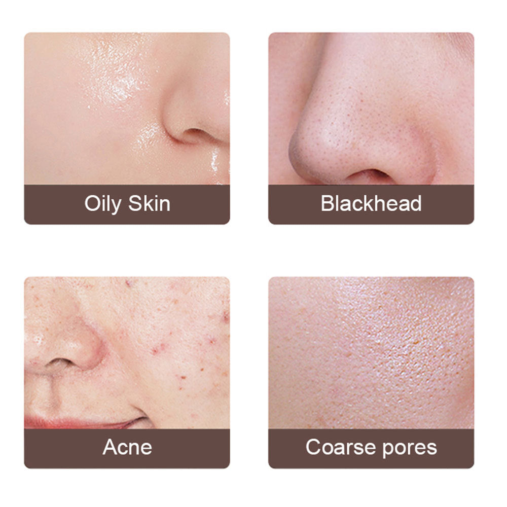 DermaGlow™ Ultrasonic Pro – Appareil Nettoyant Visage Haute Précision